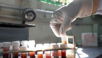 kryven-test-izsledvane-probi