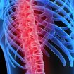 osteoporoza