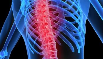 osteoporoza