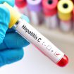 hepatit-c