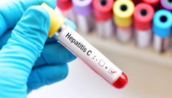 hepatit-c