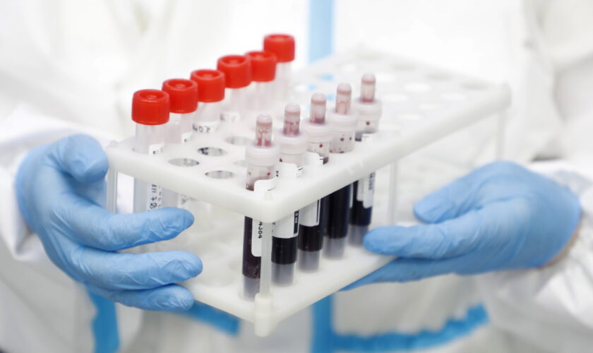 koronavirus